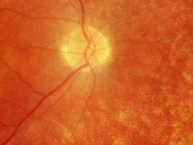 article_blindness